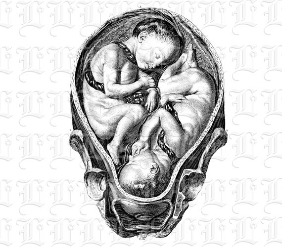 Human Twins Fetus in Womb Vintage Clip Art Illustration